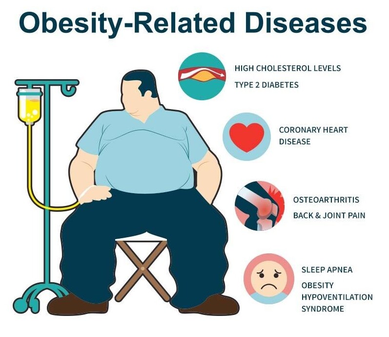 Obesity diseases