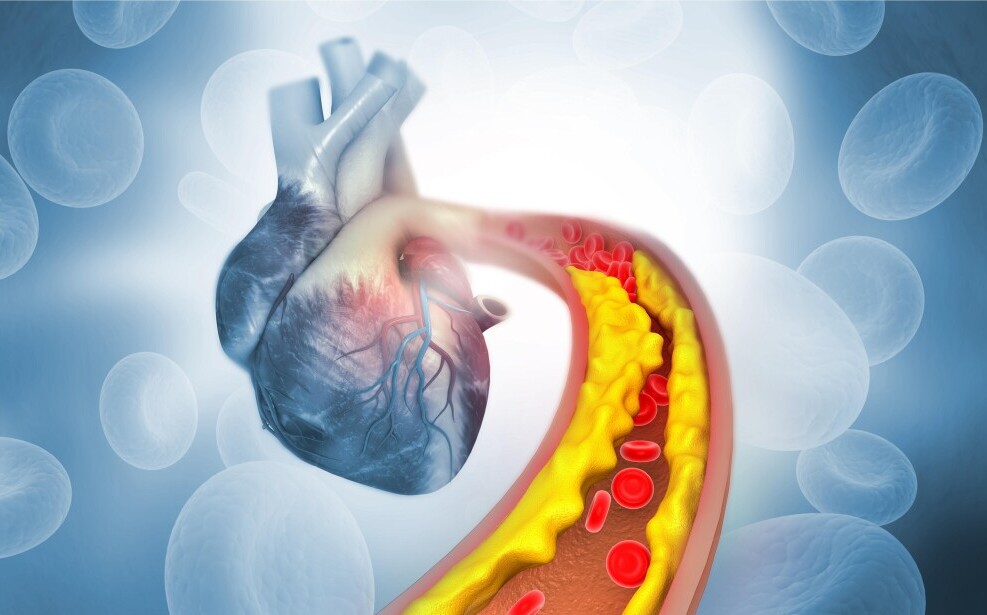 Cholesterol and heart health