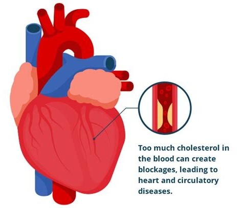 Tips for optimizing cholesterol 